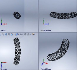 3d stent artery