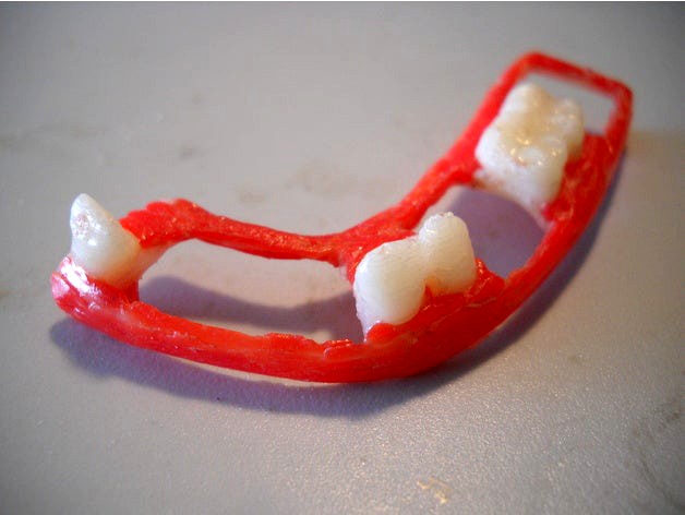 dental partial dentures by caj