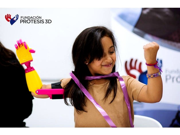 Arm V-Marti by FundacionProtesis3D