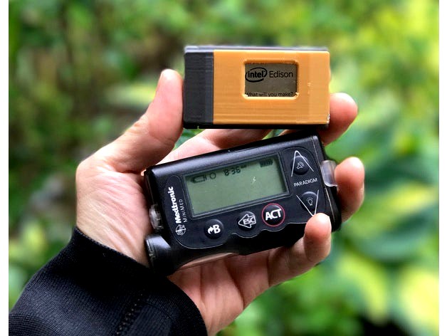 Modular OpenAPS enclosure by rsilvers