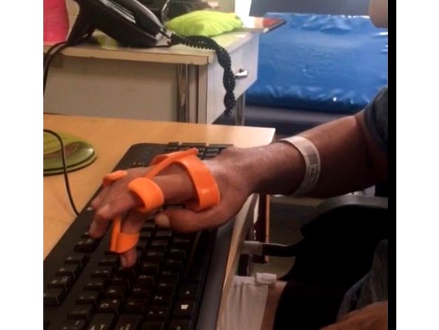 Orthosis for Typing and touchscreen  by GabrielaB