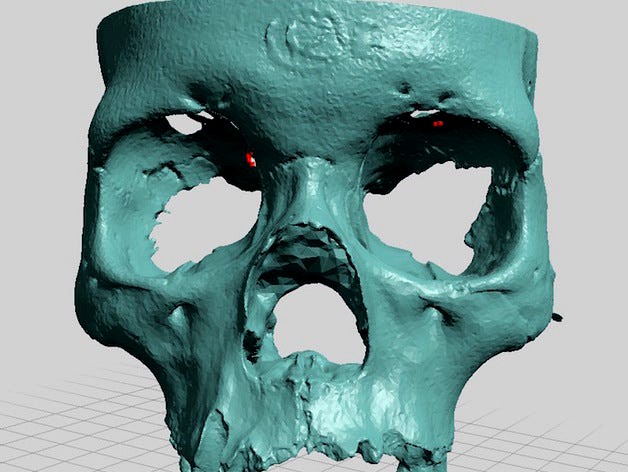 Partial Human Skull, Asian Ancestry, Facial Region Scan by dricketts