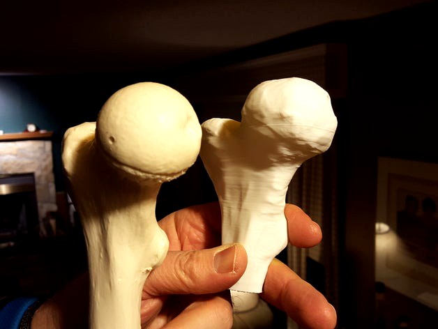Alberta High School CTS - 3D Printed Bone Replacements by 2teacher4u