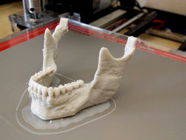 Human Skull - separated mandible and connectors by skriver