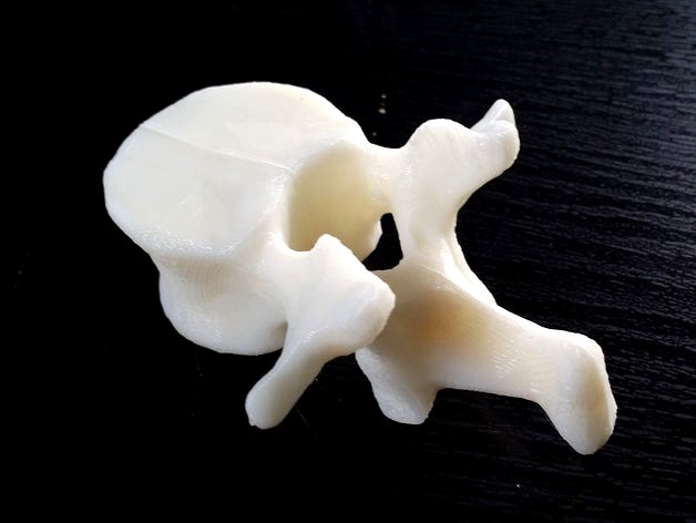 Lumbar Vertebrae and Sacrum, in easy printable format by dantana