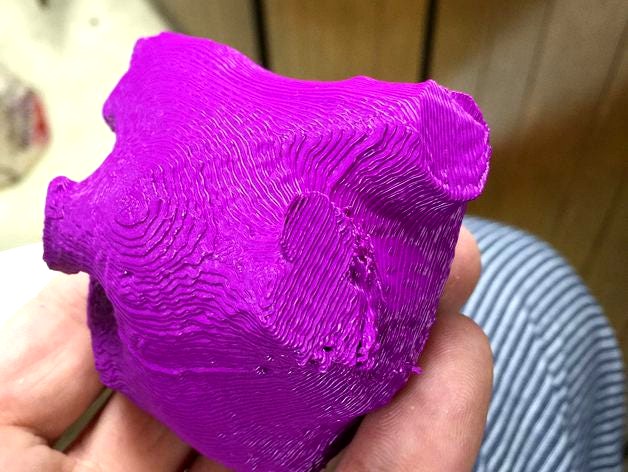 Left Atrium from CT data by SeeDiph