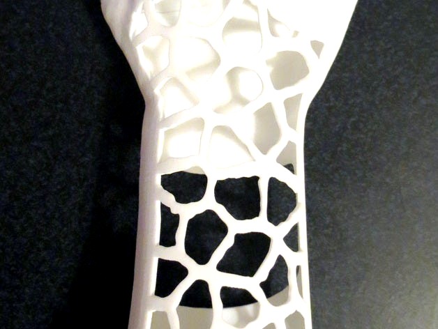 Hollies arm V2 by Anthromod