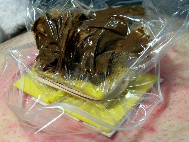 Colostomy Device by Phelps3D