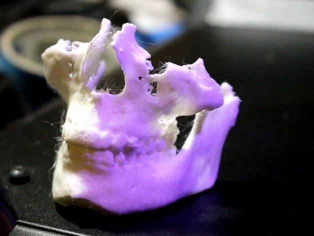 dicom to stl with geomagics skull by oriface