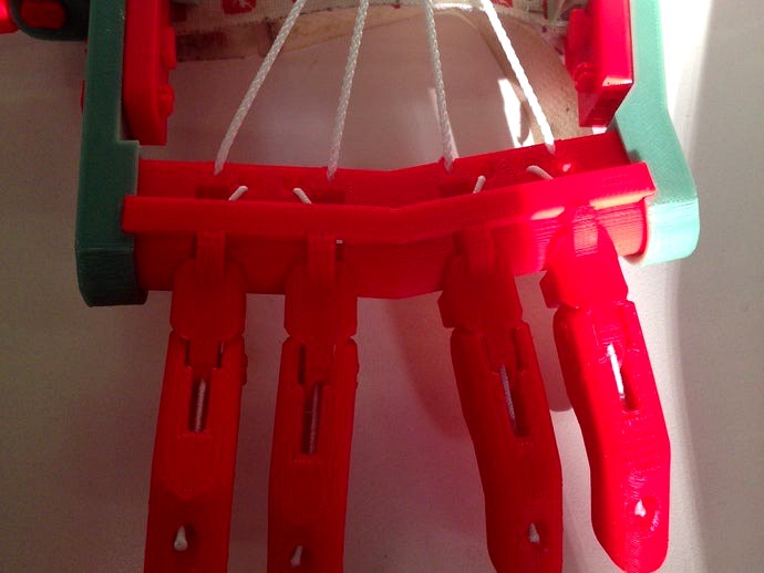 Robohand knuckle block modification (left) by michelefaini