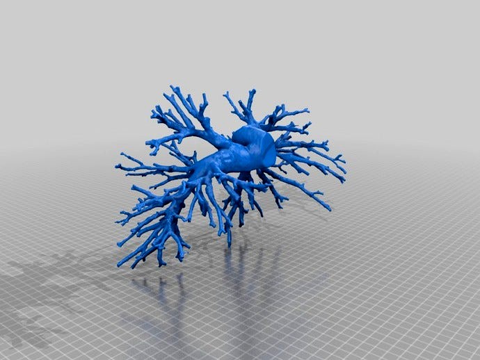 Pulmonary arteries (human) cleaned / printable by meshmixer