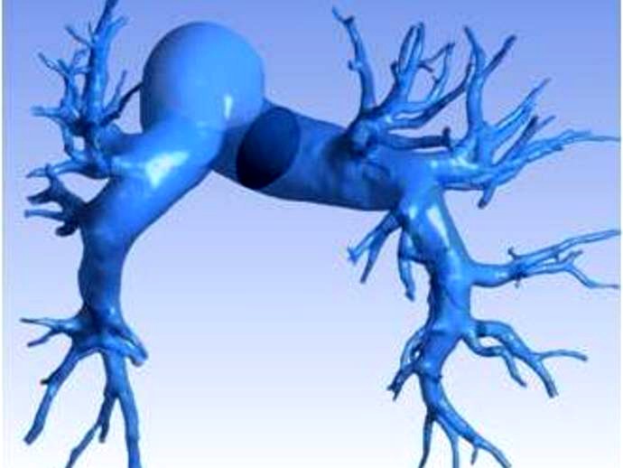 Pulmonary arteries (human) by finole