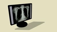 LCD Monitor