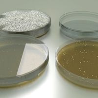 Petri Dish with Bacteria Colony