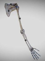 Upper limb