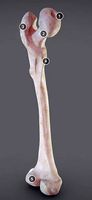 Femur