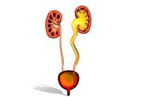 Type 4 - Vesicoureteral Reflux - VUR - Pediatric Surgery