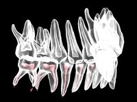 Primary teeth anatomy model | 3D