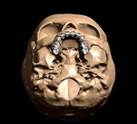 Human child skull anatomy model with individual teeth | 3D