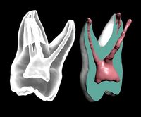 Maxillary first molar with pulp | 3D