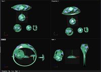 geometric sets  | 3D