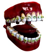Mouth with Braces