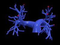 Pulmonary arteries