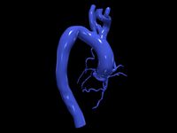 Coronary arteries and aorta