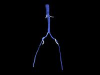 Aortofemoral