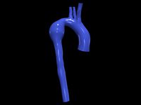 Aorta
