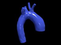 Aorta