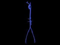 Aortofemoral