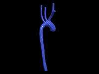 Aorta