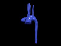 Aorta