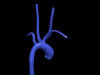 Aorta