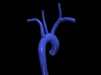 Aorta