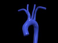 Aorta