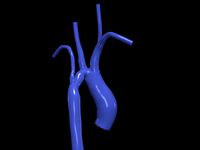 Aorta