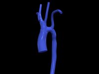 Aorta