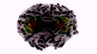 Monkeypox Virus smallpox epidemic infection illness flu