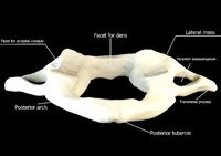 Atlas 1st cervical vertebra 3D model