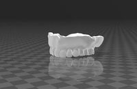 maxilla denture