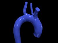 3d model of aorta | 3D