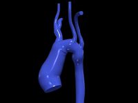 3d model of aorta | 3D