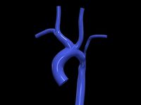3d model of aorta | 3D