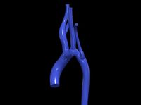 3d model of aorta | 3D