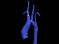 3d model of aorta | 3D