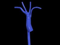 3d model of aorta | 3D