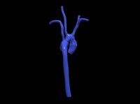 3d model of aorta | 3D