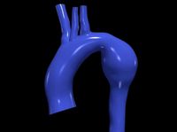 3d model of aorta | 3D